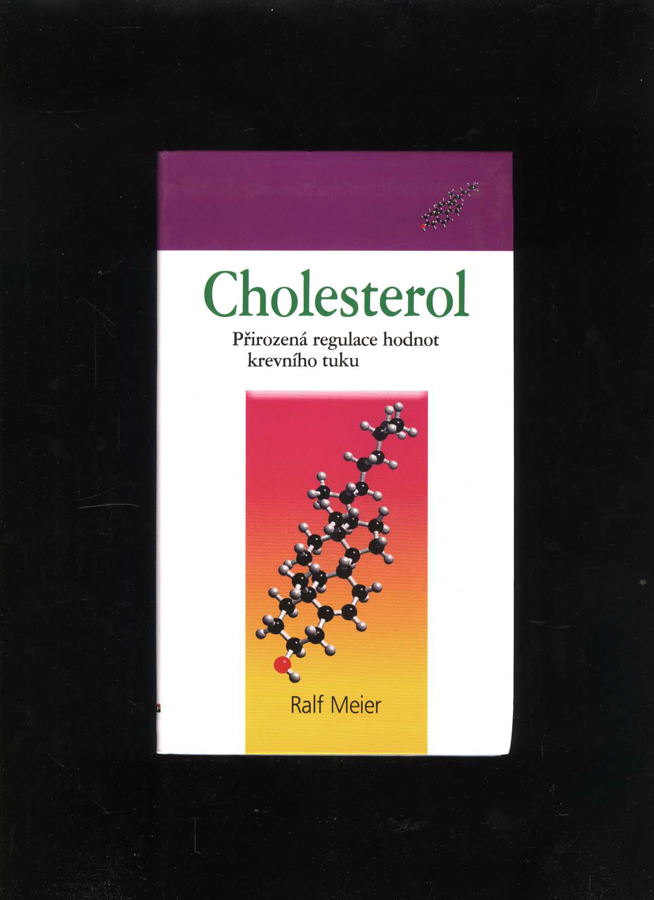 Cholesterol (Ralf Meier)